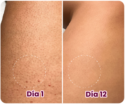 Testimonial